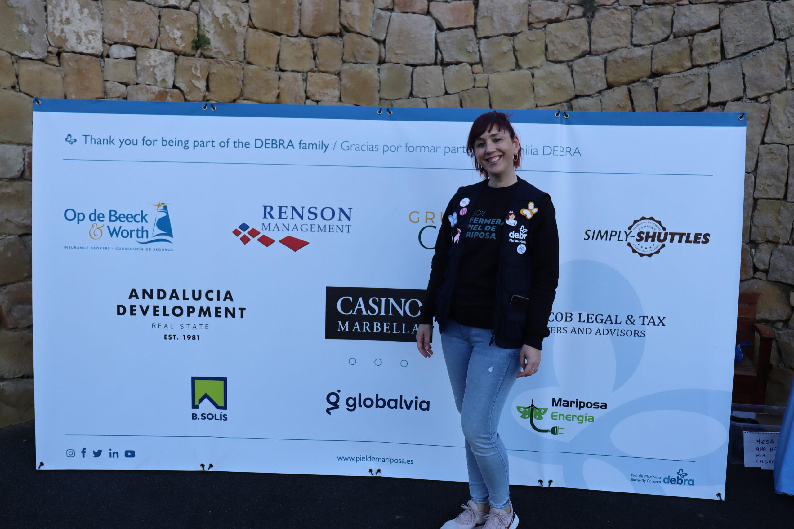 Casino Marbella patrocinador incondicional de la asociación Debra Piel de Mariposa