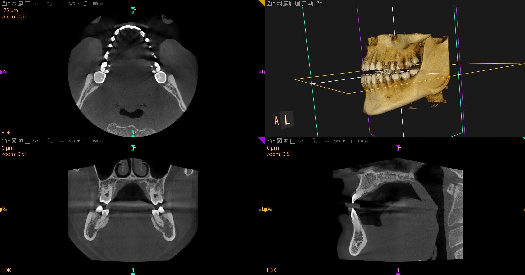 Quirónsalud Marbella incorpora la radiografía panorámica dental de alta resolución